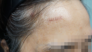 After Image