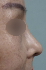 After Image