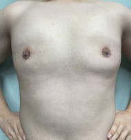 After Image