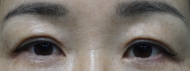 After Image